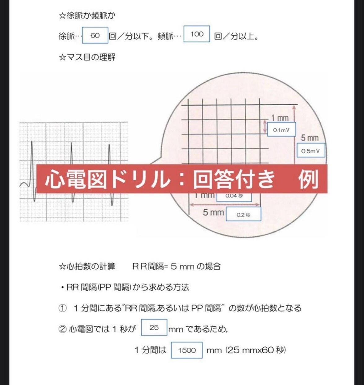 心電図検定2級資格取得サポートをします 心電図検定1級取得者が資格取得サポートをします！ イメージ3