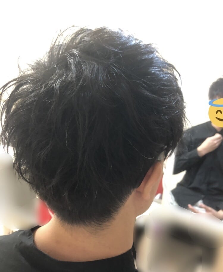 植毛・育毛剤なし！薄毛改善した方法教えます その決断、ちょっと待ってください。 イメージ5