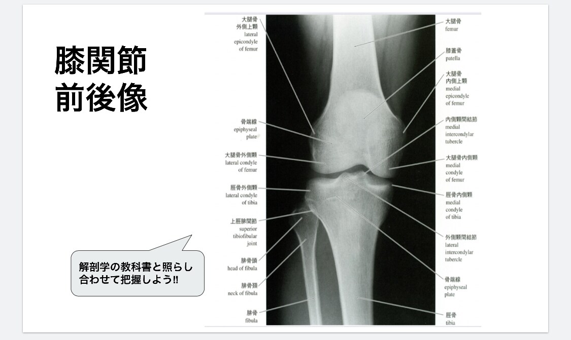 膝関節についての資料を提供します トレーナーやセラピスト必見！膝関節のあれこれが分かります！ イメージ3