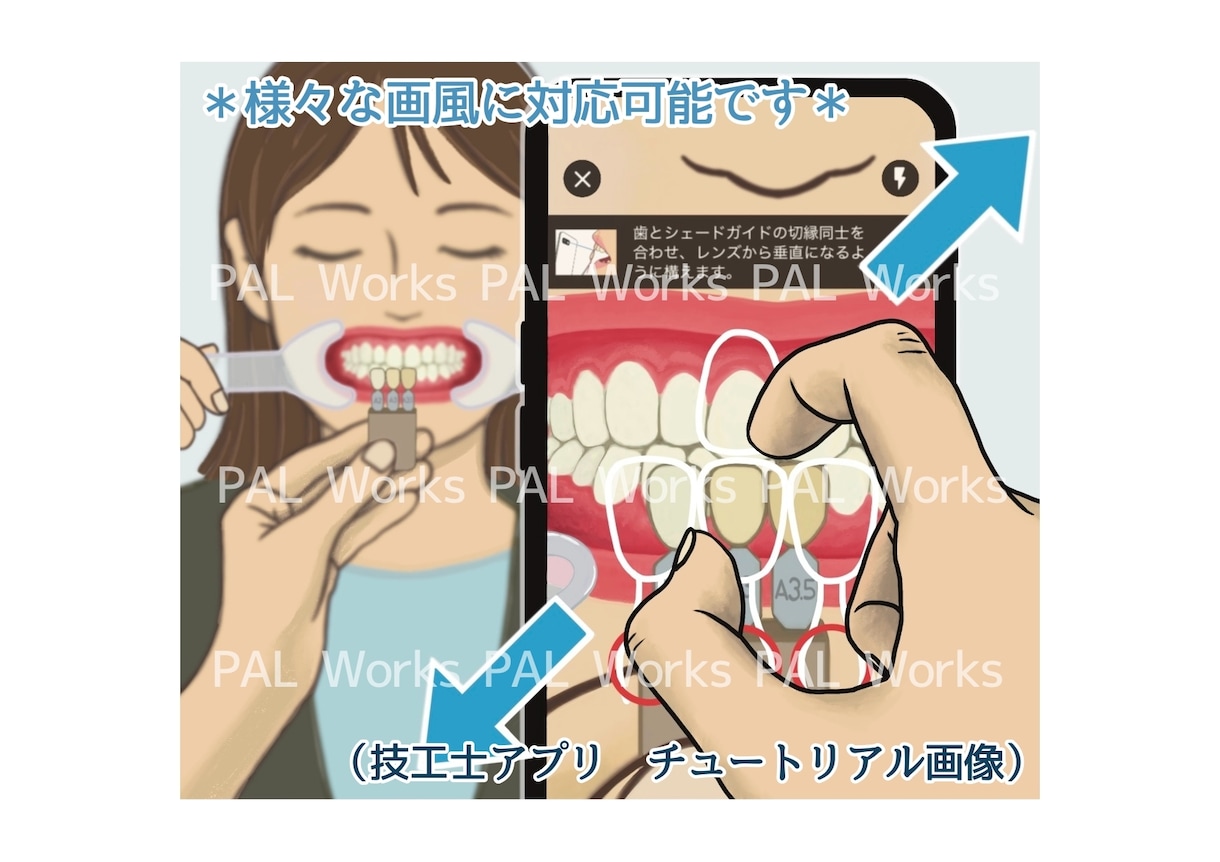 芸大卒•現役歯科衛生士が歯科イラストを描きます ブログ・学会などに！専門用語や細かい指示にも対応できます！ イメージ3