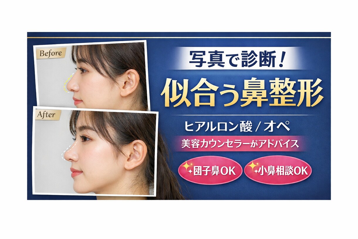 写真で診断！あなたに似合う鼻整形提案します 現役カウンセラーが自然なデザインができる施術提案します！ イメージ1