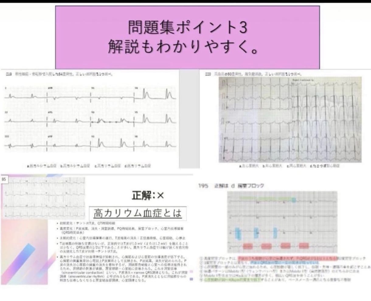 心電図検定3級勉強資料セットをお売りします 心電図検定1級取得者が作成した3級試験対策セット！ イメージ4