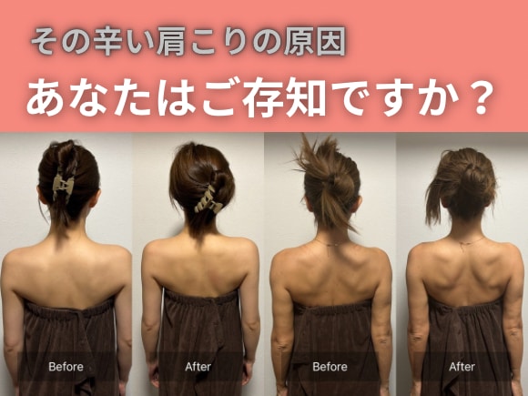 肩甲骨整体師が肩こりの原因を一緒に整理します 肩こりの原因、肩甲骨のプロが教えます イメージ1