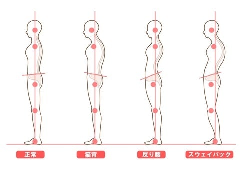 特別価格！写真2枚で姿勢診断＆改善提案します 誰にでもわかりやすく現役ピラティスインストラクターが診断。 イメージ3