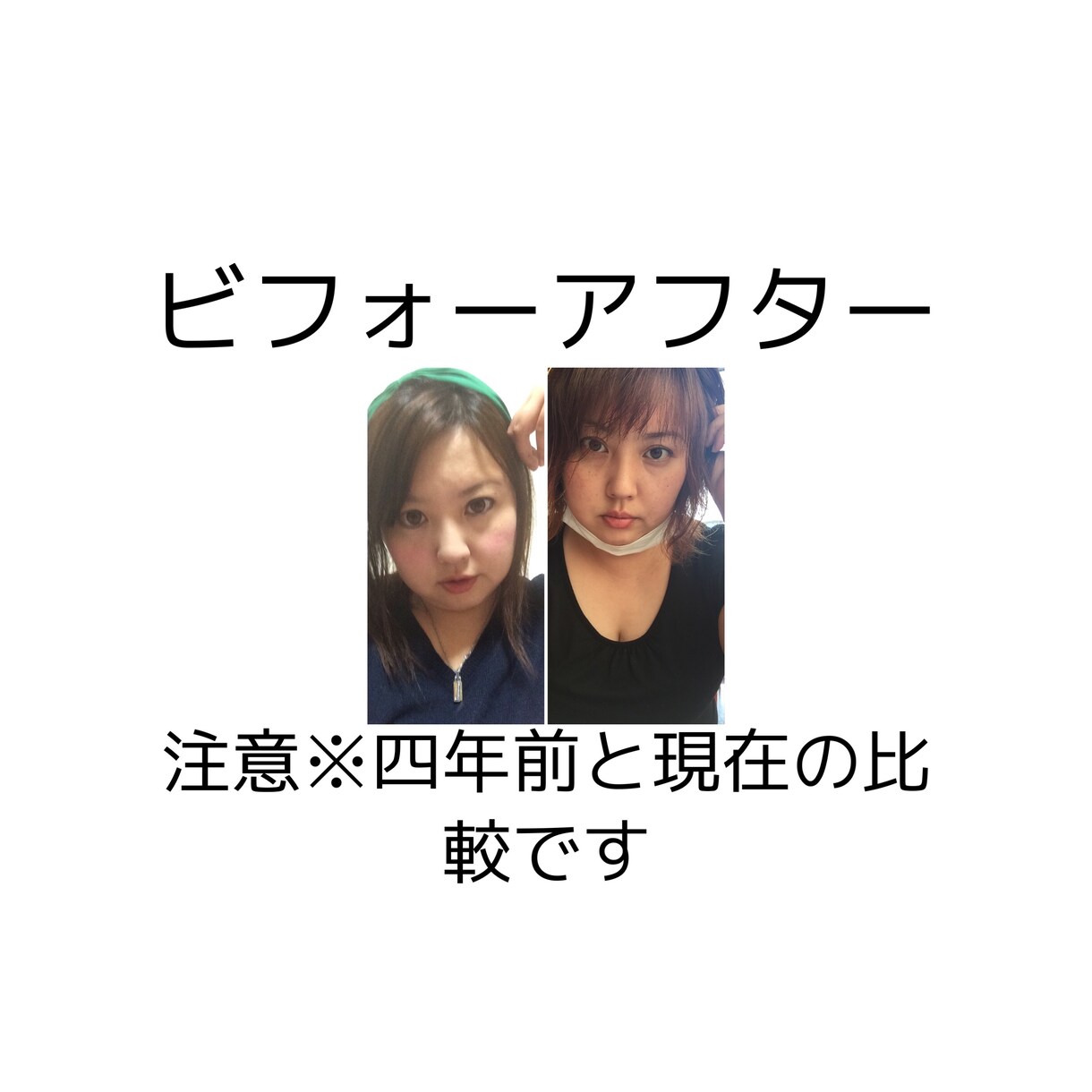 女性専門！美容整形をお考えの方私が相談に乗ります プチ整形、美容整形  を知りたい方へ。 イメージ1