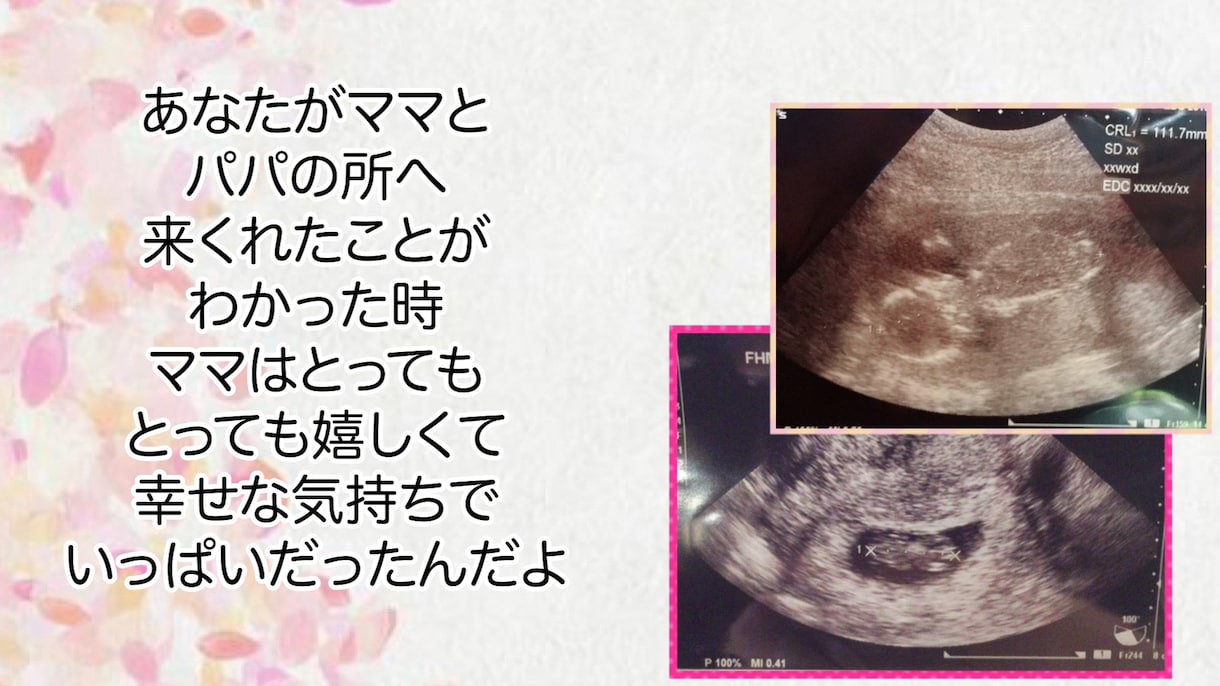 大切な思い出の✳︎フォトムービー✳︎を作成します しまい込まれた思い出を素敵なプレゼントにしませんか？ イメージ2