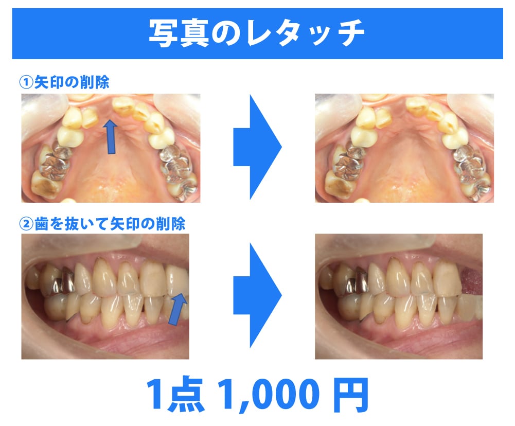 お急ぎフォトショ対応！承ります 写真の切抜き/合成/修正などを即日対応致します！ イメージ2