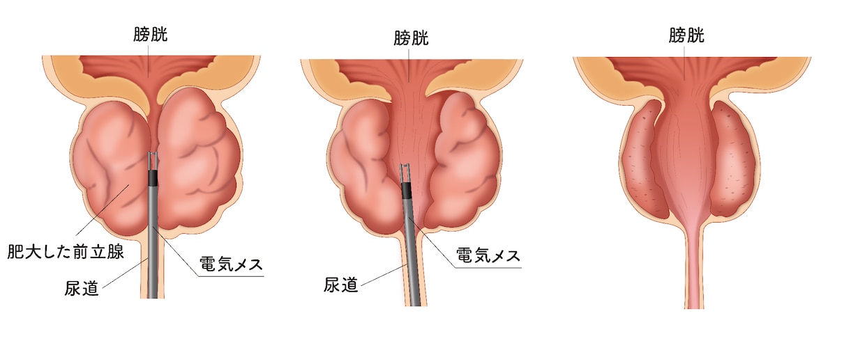 分かりやく見やすい！医療・解剖イラストを作成します 医療系イラスト実績あり！WEB・資料・論文作成をサポート！ イメージ5