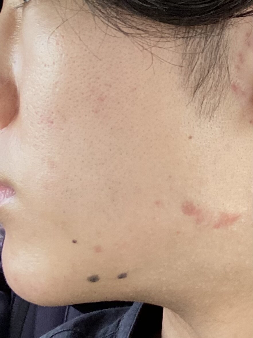 メンズファッション、髪型、ニキビ治します 垢抜けたい、モテたい男子必見！元アパレル店員が教えます！ イメージ6