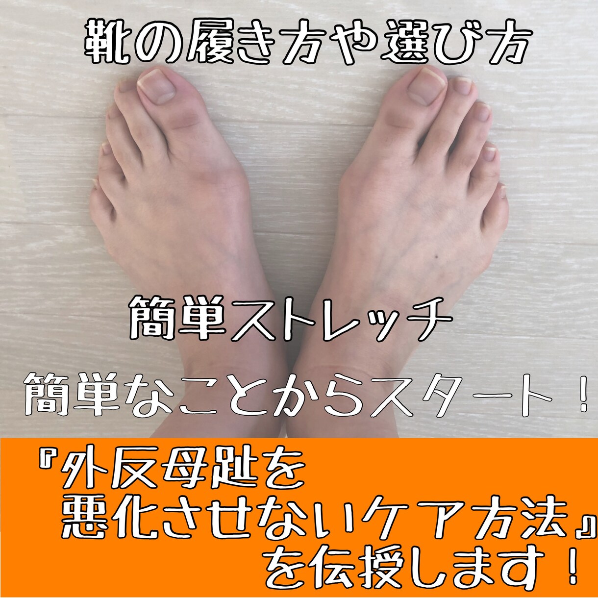 外反母趾を悪化させないケア方法を伝授します えっ？こんなこと？？すぐできる事からスタートしませんか？ イメージ1