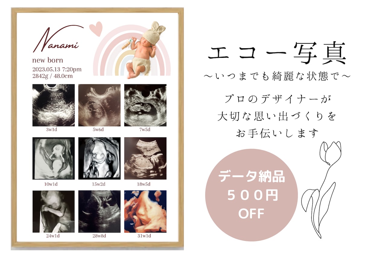 赤ちゃんの写真入りエコー写真ポスター作ります 大切な赤ちゃんの思い出をおしゃれに残しませんか？ イメージ4