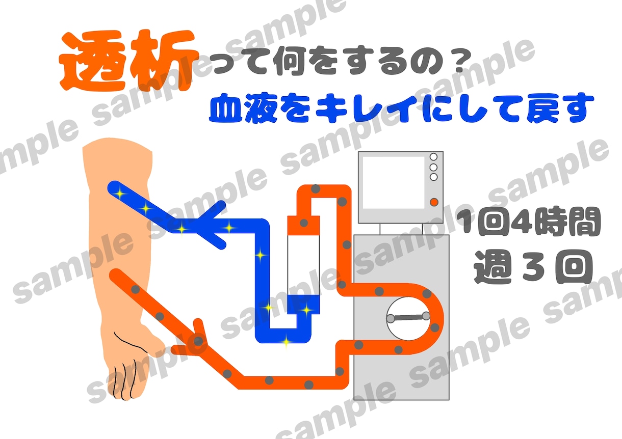 透析患説明がラクになる図解４枚セット作成します ３秒で伝わる！患者説明を楽にする図解 イメージ2