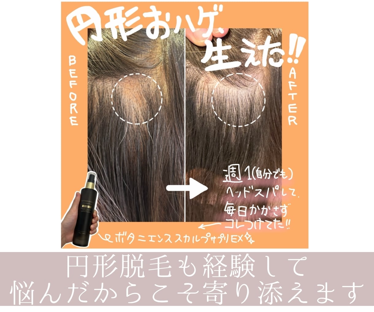 髪と頭皮にお悩みの方へ専門家が答えます 美容師免許保有・現役ヘッドスパニストの美容お悩み相談室 イメージ6