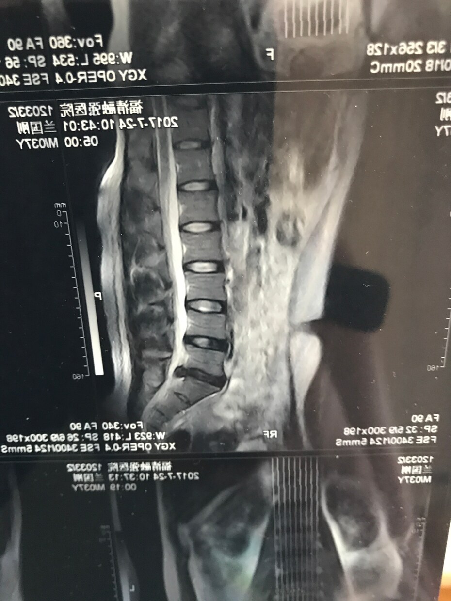 ヘルニアなど、脊椎の病気、自身で治せます 脊椎に病気を抱えている方々、自分自身の力で治せます。 イメージ1
