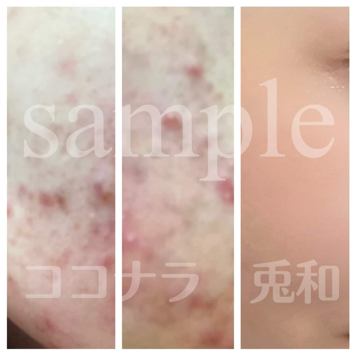 現実的に美しくなるお手伝いをします メタボ指導、美容クリニック看護師経験のある私がお手伝いします イメージ2