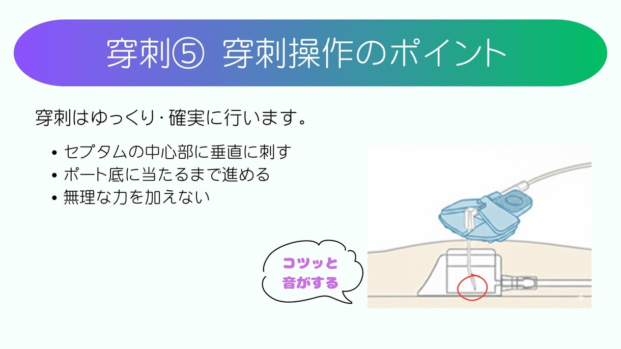 新人看護師のためのCVポート管理資料あります 手順から看護のポイントまでこれで完結！チェックリスト付き イメージ7