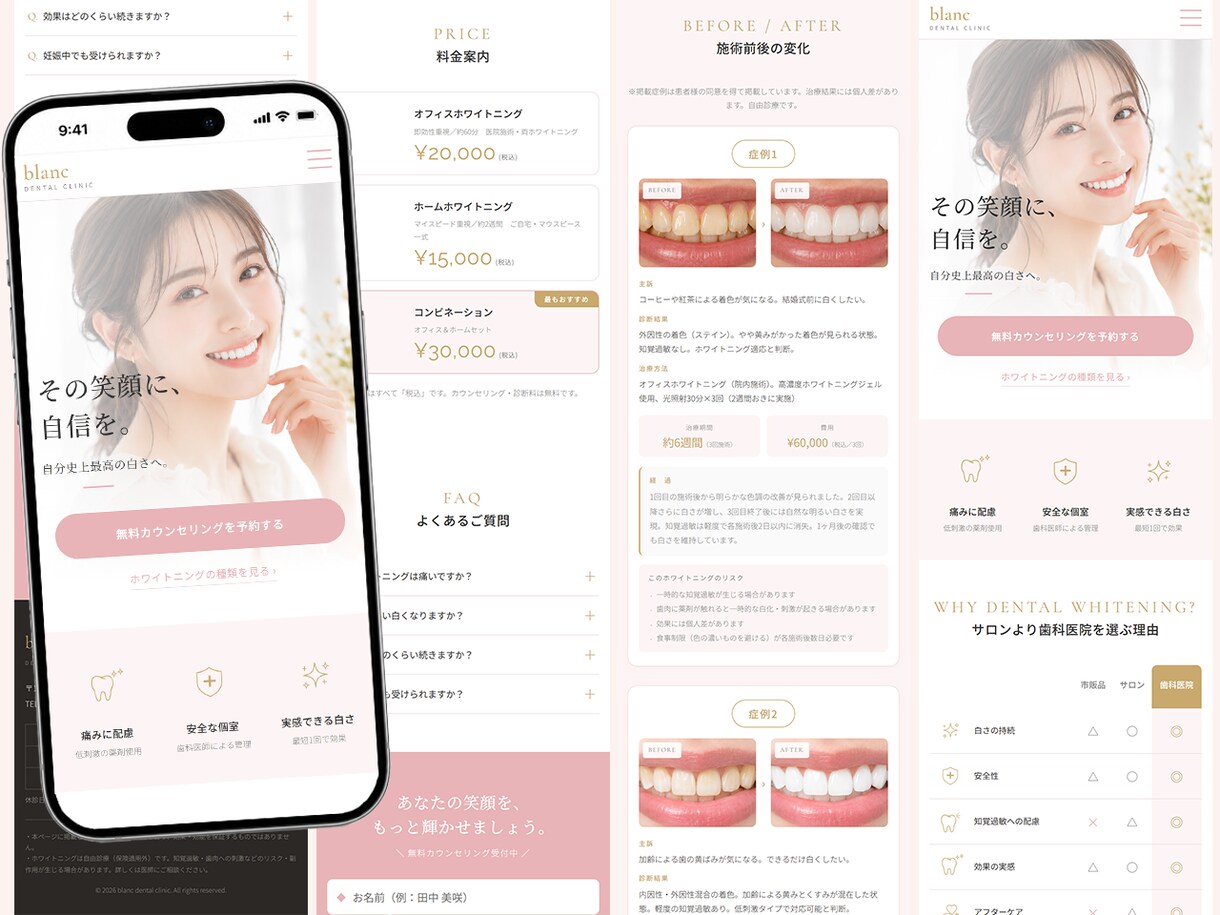 歯科医院専門｜集患につながるLPを制作します 医療広告ガイドライン準拠・スマホファースト・短納期対応。 イメージ4