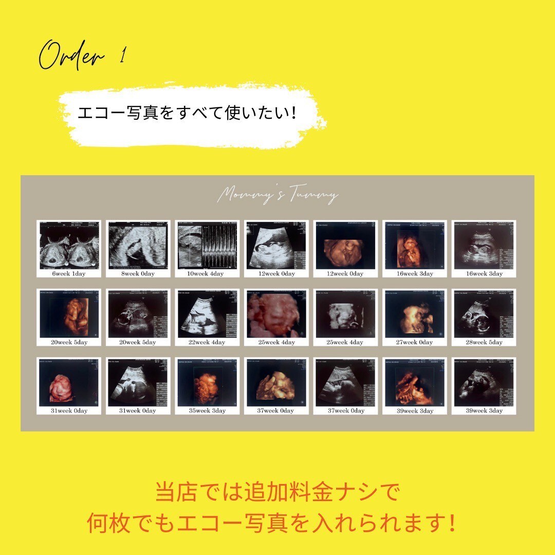 世界に一つだけのエコーアルバムを作ります お腹の中から始まる家族の物語を、永遠に残すお手伝いをします。 イメージ5