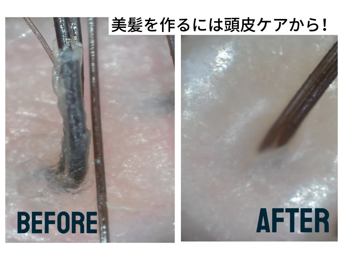 頭皮・ヘッドスパの専門相談にのります 頭皮タイプ診断と最適ケアをプロが提案します イメージ1