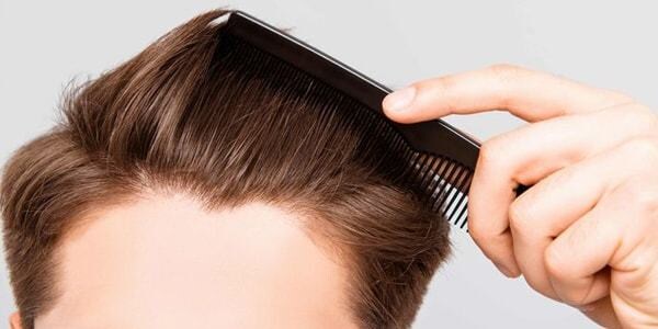 抜け毛！かゆみの原因は？簡単な頭皮診断をします 男女問わず自分に合うヘアケアを美容師以外から聞きたい方へ イメージ1