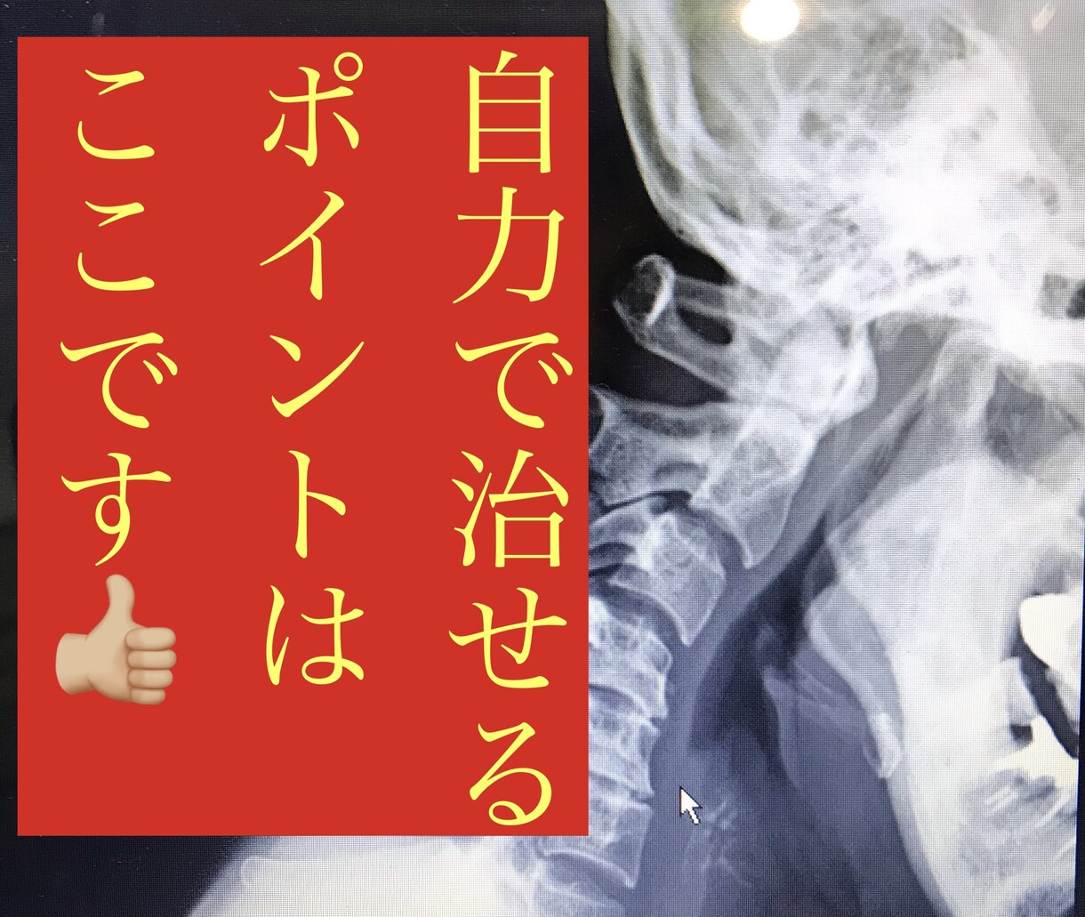 どこを揉んだら楽になるの？不調部分別に教えます 体が楽になる隠れた秘密部分を教えてしまいます。 イメージ1