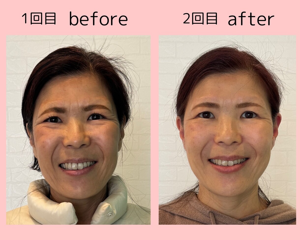 理想のお顔にデザイン、あなたの魅力を引き出します 正しい表情筋の使い方を知り日常に落とし込み、別人級に変化 イメージ2