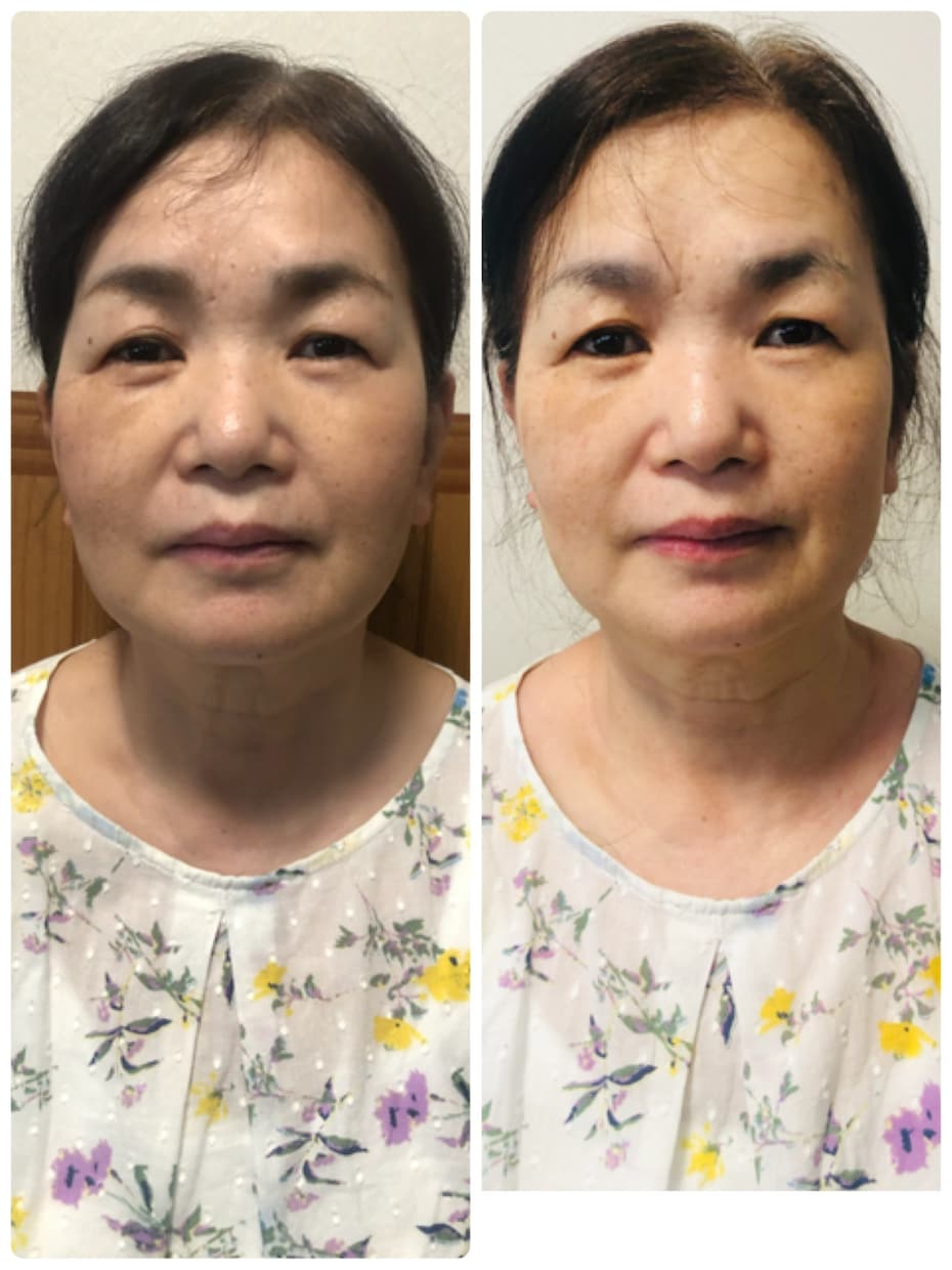 辛い肩首の凝りをほぐしスッキリとした小顔を叶えます たった5分で本当に綺麗になれる！輪郭シェイプケアマッサージ イメージ2