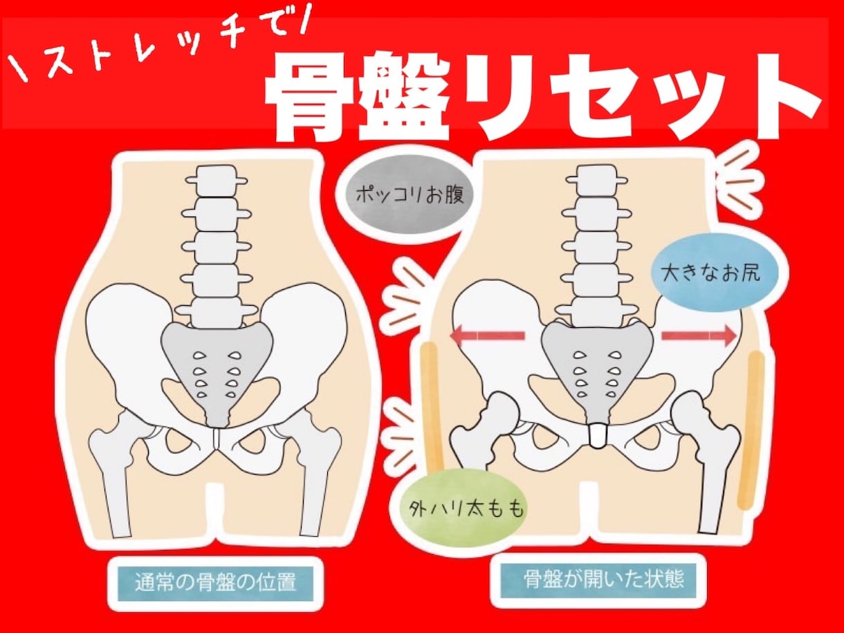 ストレッチで骨盤リセットします ストレッチで骨盤の歪みをリセットし、姿勢ごと痩せる イメージ1