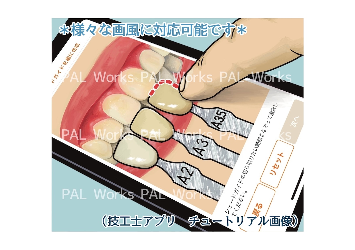 芸大卒•現役歯科衛生士が歯科イラストを描きます ブログ・学会などに！専門用語や細かい指示にも対応できます！ イメージ5