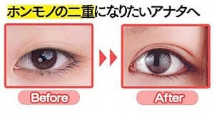 まぶたが重たい方.奥二重な方、二重にさせます 綺麗な二重にしたくて悩んでました。 イメージ2