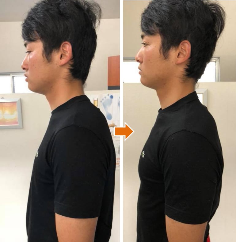 猫背を自分で10秒で矯正できる最強矯正技を教えます 体の軸の第一人者が、発見した10秒でできる猫背姿勢矯正法 イメージ6