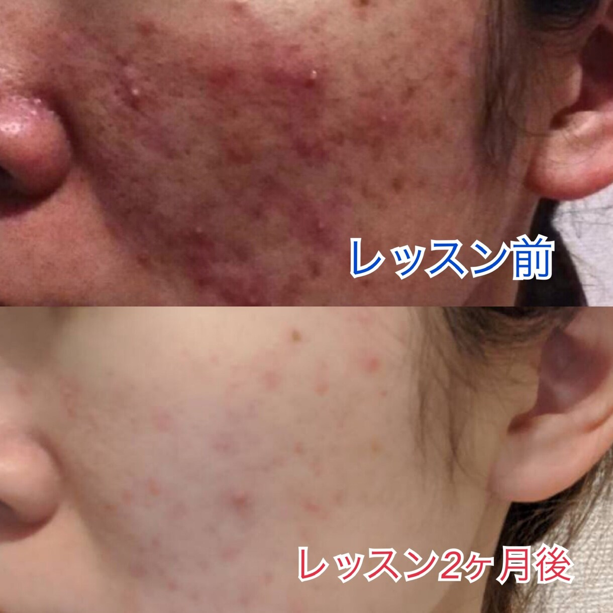 最近の美肌術を教えます あなたの肌に1番適した化粧品、お手入れ方法を教えます！ イメージ1