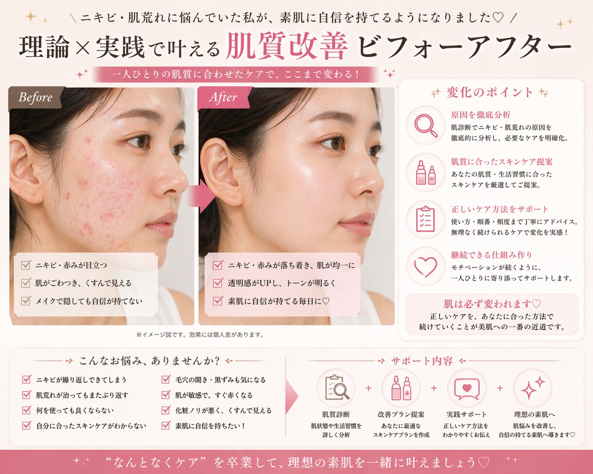 肌質に合わせた最適ケアを提案します 今のスキンケアが合ってるかを一つずつチェックします！ イメージ2