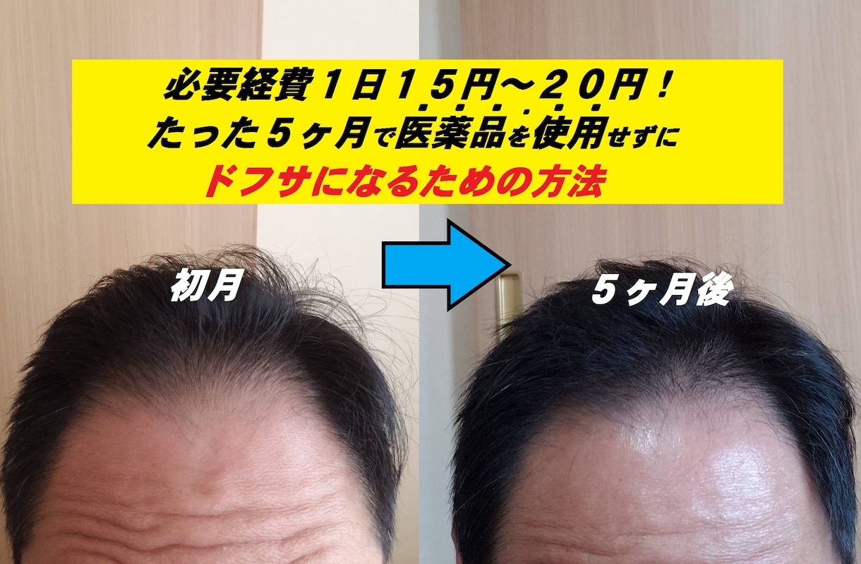 ミノキシジル無しでこの効果！写真のように改善します いつまでミノタブ、フィンペシアの副作用で消耗してるんですか？ イメージ1
