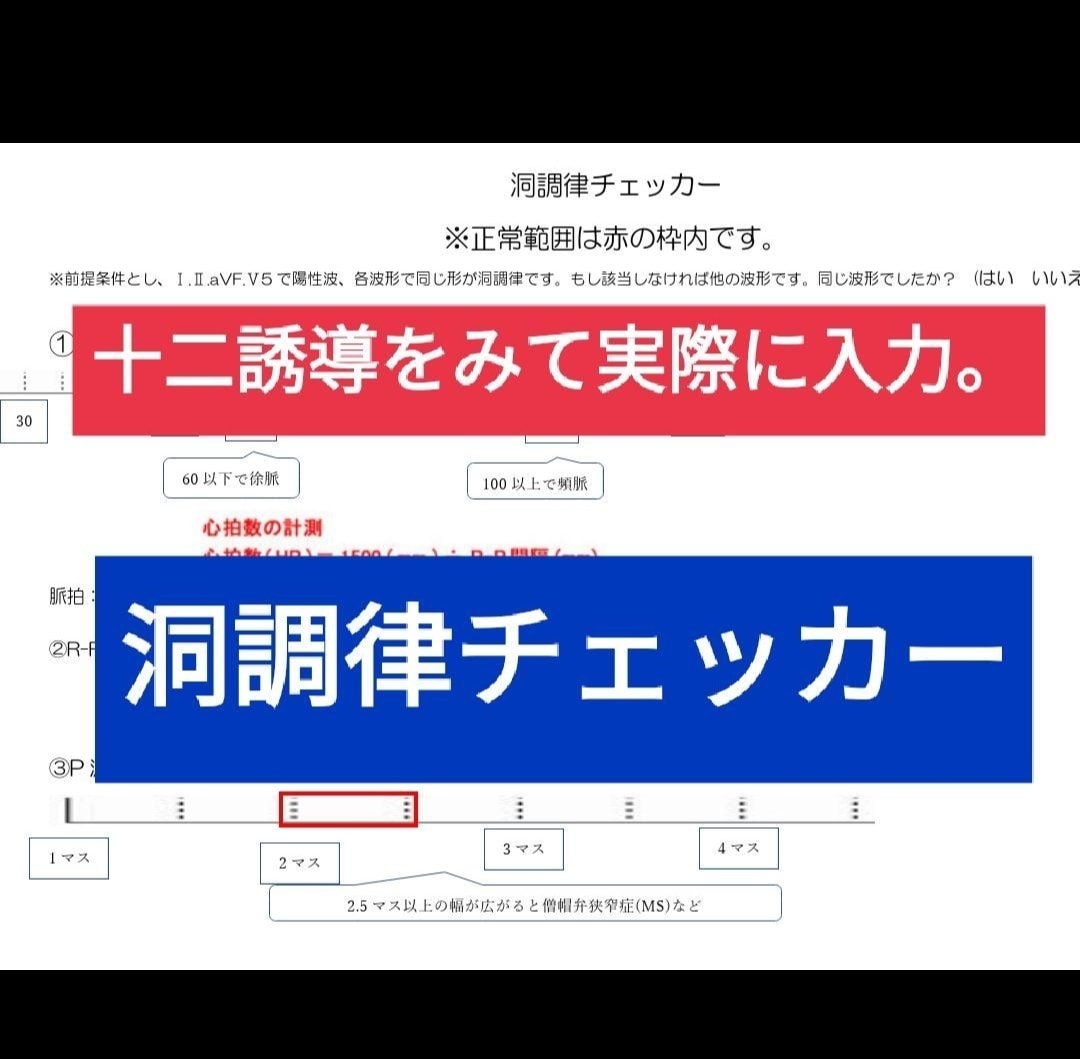 洞調律チェッカーを提供します 心電図をみるのが楽しくなる！洞調律チェッカーです。 イメージ1