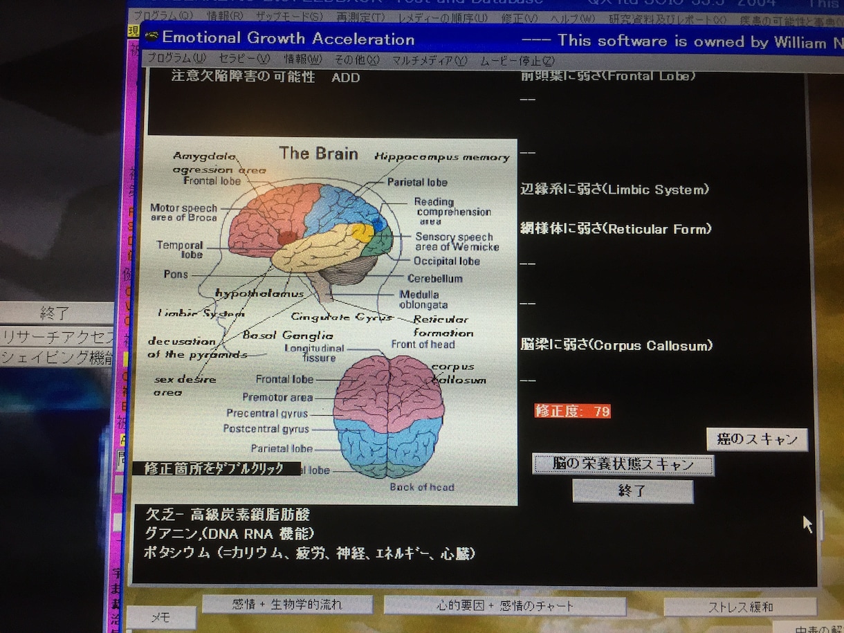 QX-SCIOであなたの波動を測定修正いたします エネルギー的乱れを見つけ、調整いたします。 イメージ3