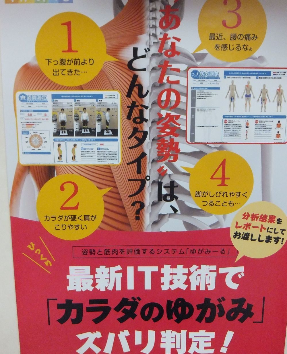 遠隔操作で身体のゆがみ判定します 綺麗な体型を保ちたい方・いつも同じところが痛くなる方 イメージ1
