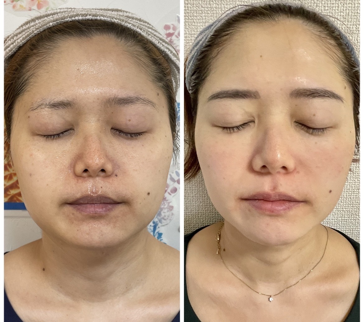 極秘！シミだらけの私が美肌を取り戻した方法教えます 実体験に基づいた方法です！(予告なしに値上げします) イメージ1
