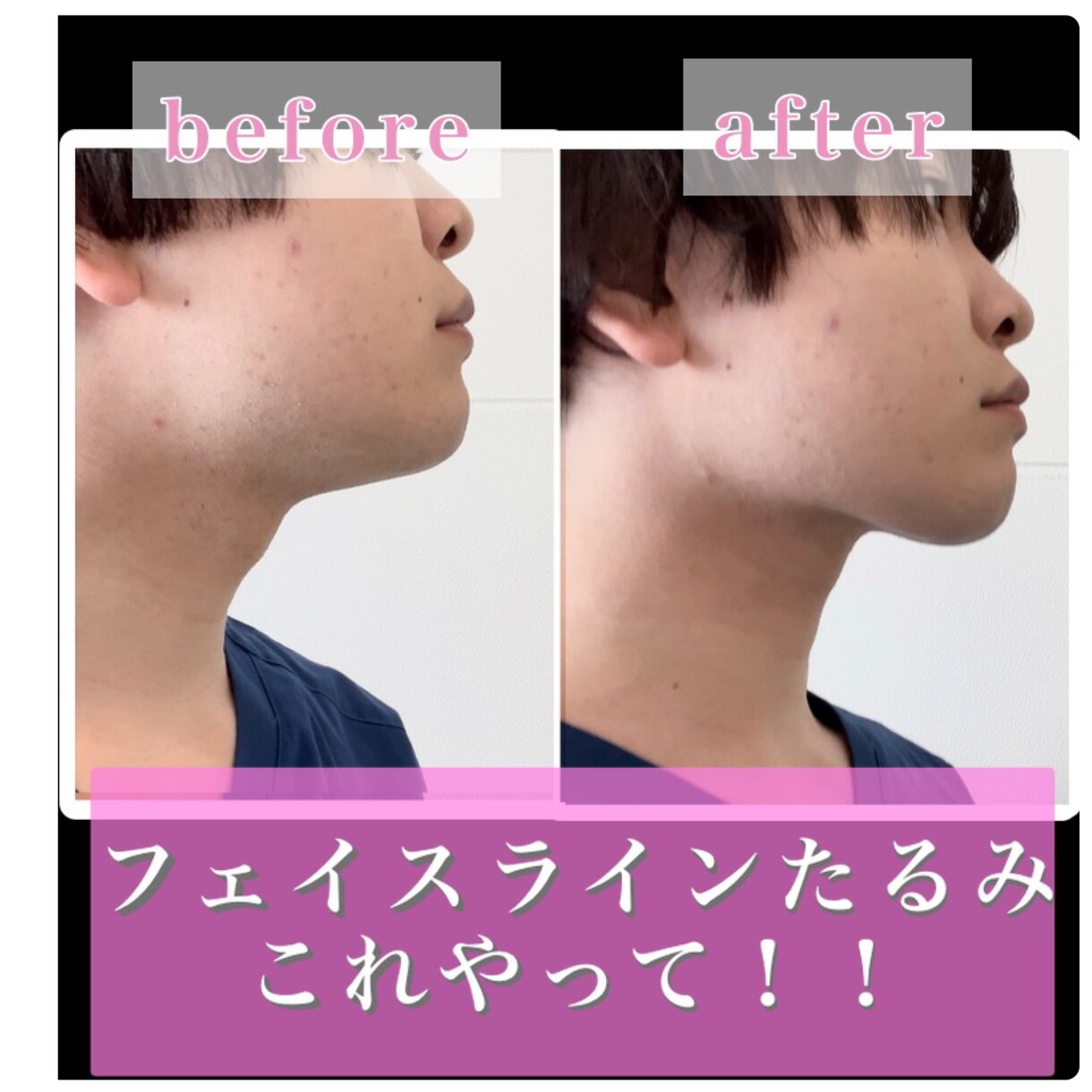 週2回、2ヶ月、小顔になれるアドバイス行います 東京都内で多くの芸能人を見た実績あり！国家資格持ちの為安心！ イメージ1