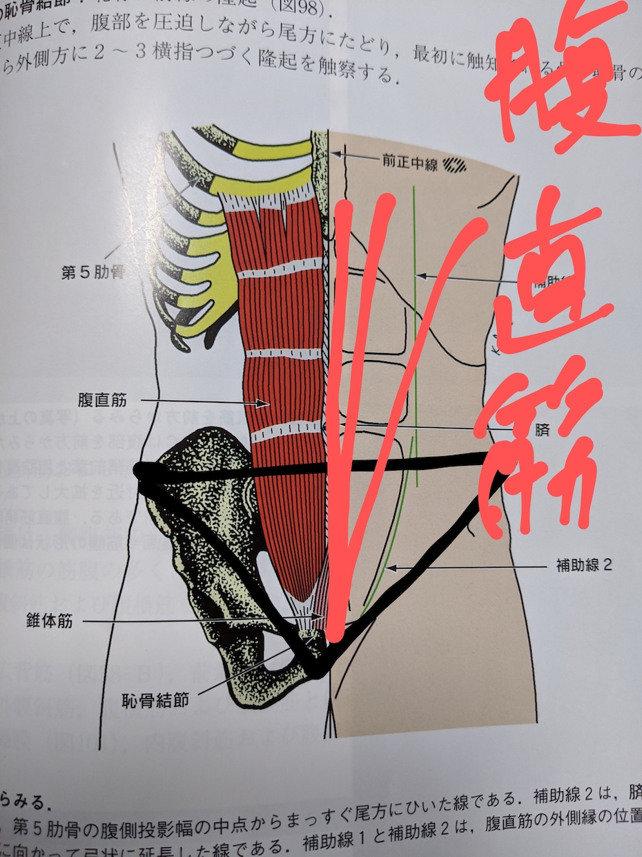 オンライン：ダイエットは【姿勢】で一段階変わります 認定理学療法士が【身体の不均衡】を医療知識で解消します！ イメージ3
