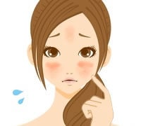 赤ら顔改善の体験談を話します 赤ら顔がほんとに嫌な人必見です！ イメージ1