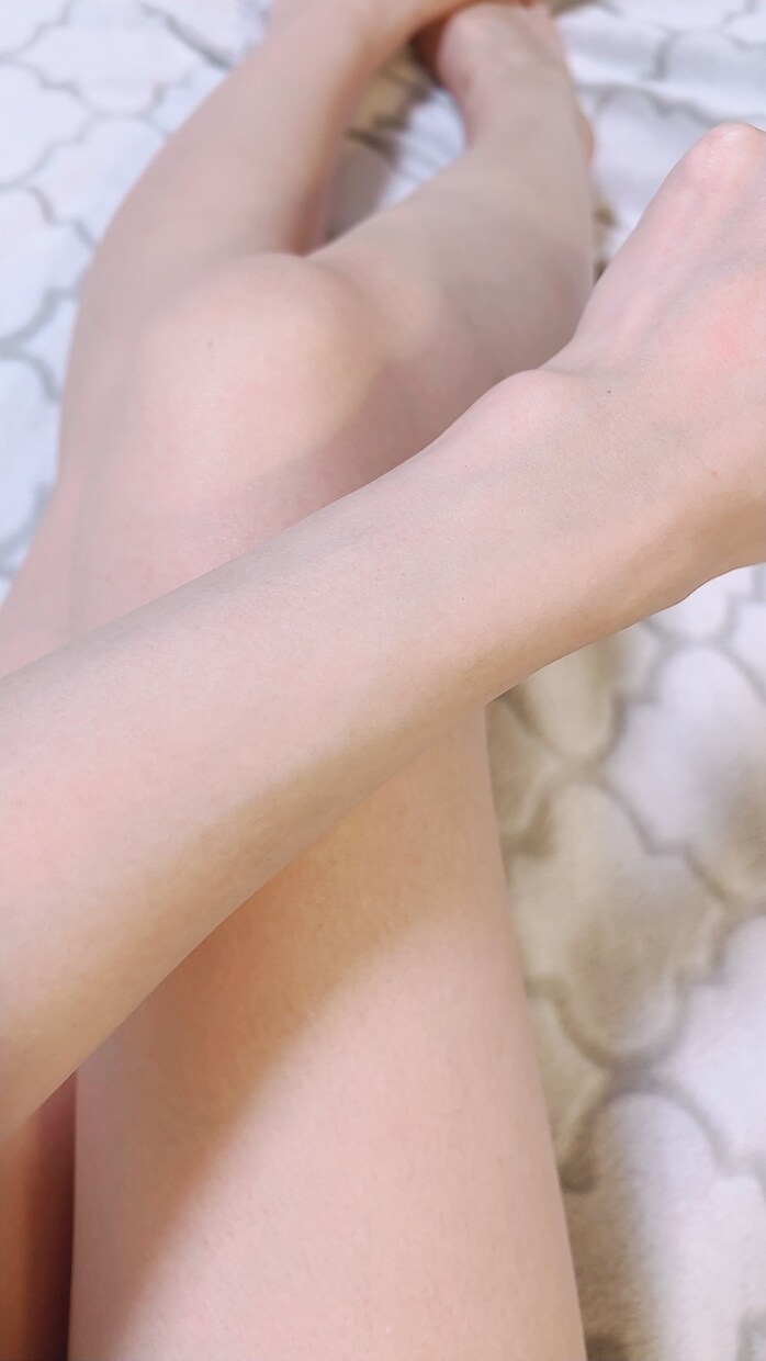 男性も女性も肌悩みに合わせた脱毛アドバイスをします 脱毛したいけれど不安が多く1歩踏み出せないあなたへ イメージ1