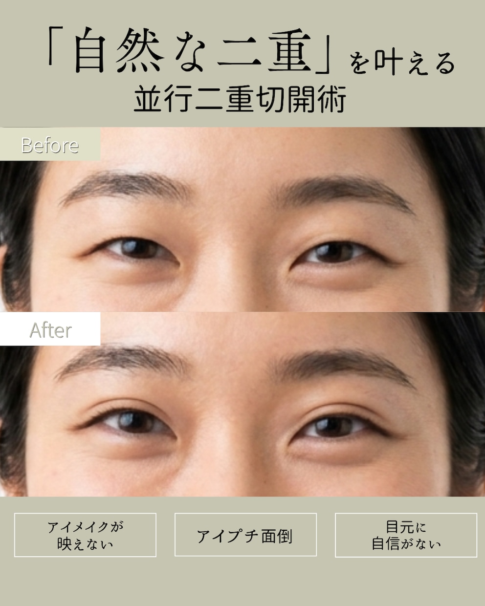 現役看護師>>>美容医療専門インスタ運用代行します SNS運用/集客・採用/アカウント設計/投稿企画・制作/分析 イメージ3