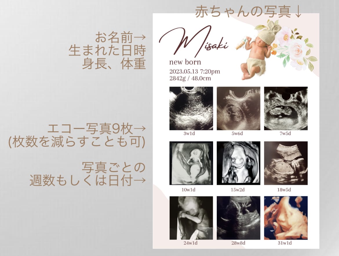 赤ちゃんの写真入りエコー写真ポスター作ります 大切な赤ちゃんの思い出をおしゃれに残しませんか？ イメージ8