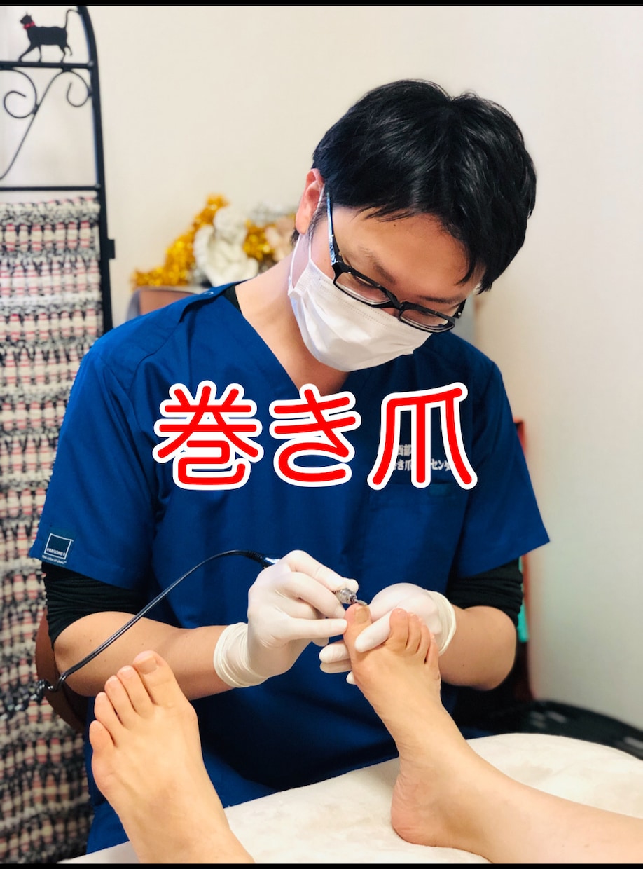 💬Coconara｜Currently accepting reservations A proven professional will speak to those who are worried about ingrown toenails Ingrown toenail foot meister...
