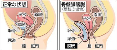 日本産後ダイエット協会認定資格取得が出来ます 産後女性の心と身体のケアで日本を元気に‼️妊娠前よりキレイ イメージ6