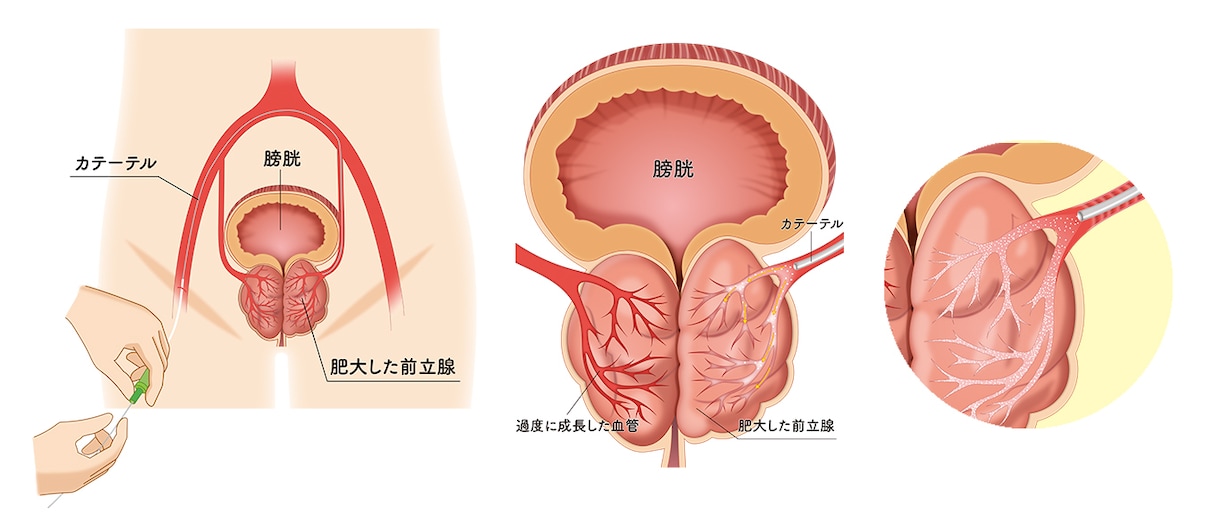 分かりやく見やすい！医療・解剖イラストを作成します 医療系イラスト実績あり！WEB・資料・論文作成をサポート！ イメージ6