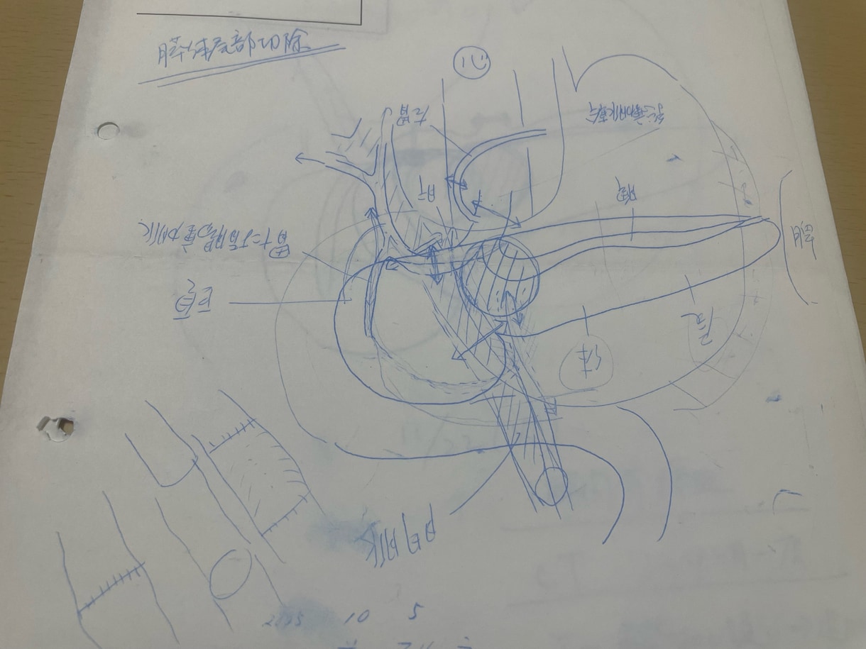 すい臓癌でも治る可能性があります すい臓癌生還者が語る病気の予兆そして完治まで イメージ4
