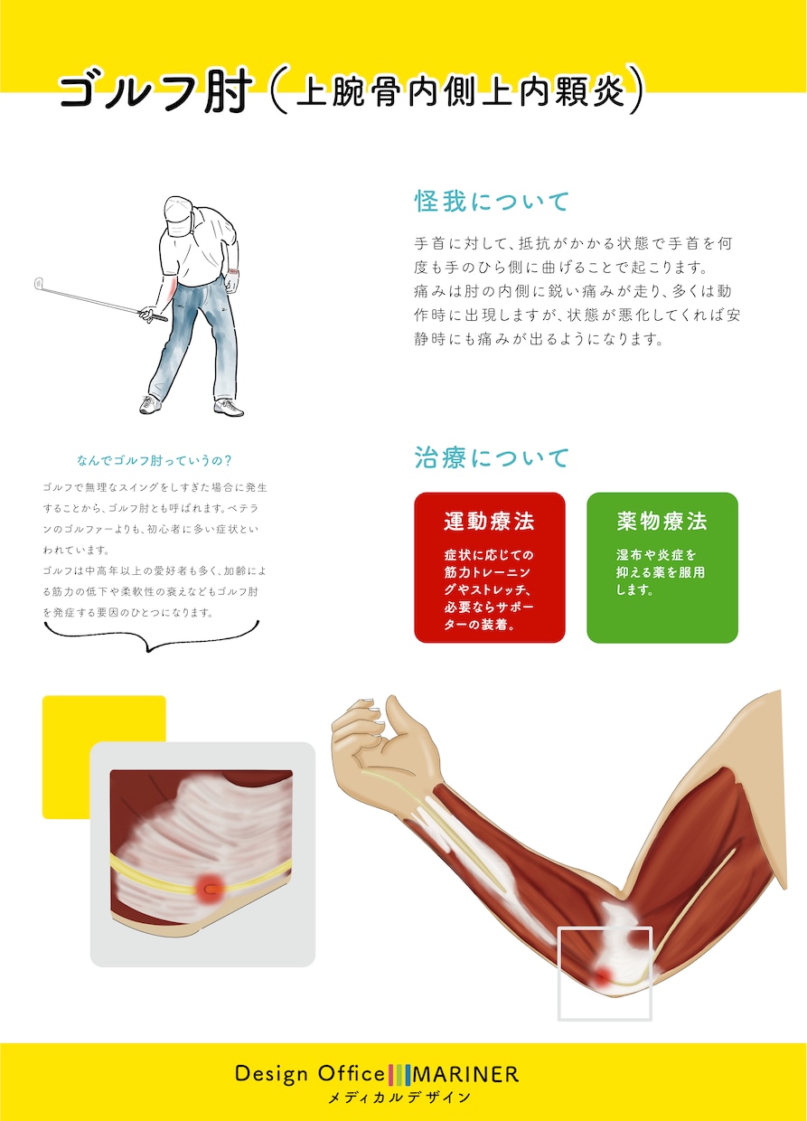 素材お探しですか？図解/美容/解剖イラスト描きます 前職理学療法士でプロのイラストレーターが描く安心クオリティ！ イメージ5
