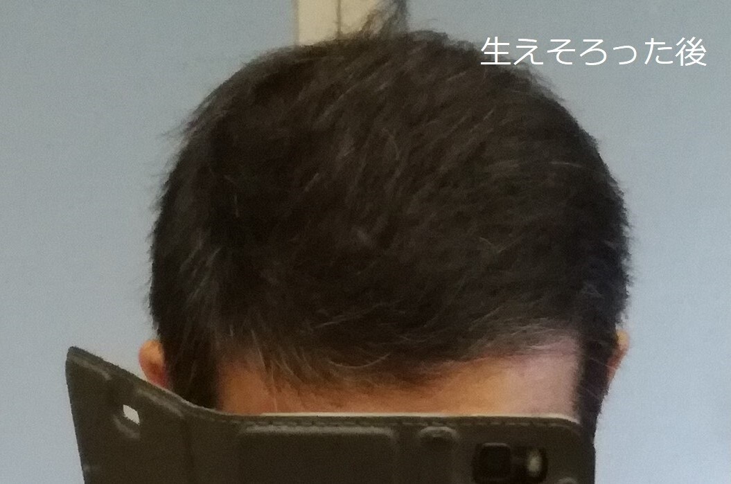 育毛についての悩みや質問にお答えします 薄毛で心に不安がある方のお悩みにお答えします イメージ3